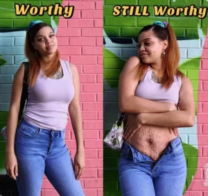 A Woman Shows the Raw Truth of Postpartum Bodies