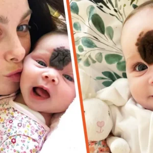 Parents Hid Baby’s Face to Shield Her from Stares — Now, at 2, She Looks ‘Gorgeous’ After Surgery