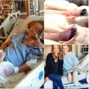 Her Legs Are Amputated After Using a Common Household Product – Now She’s Warning Women Everywhere! Her Legs Are Amputated After Using a Common Household Product – Now She’s Warning Women Everywhere!