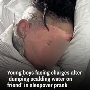 Georgia boy recovering after horrifying sleepover prank Georgia boy recovering after horrifying sleepover prank