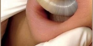 SEVEN THINGS THAT CLOG YOUR PORES AND CAUSE ACNE