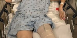 Her legs are amputated after using a common household product