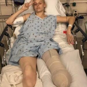 Her legs are amputated after using a common household product Her legs are amputated after using a common household product